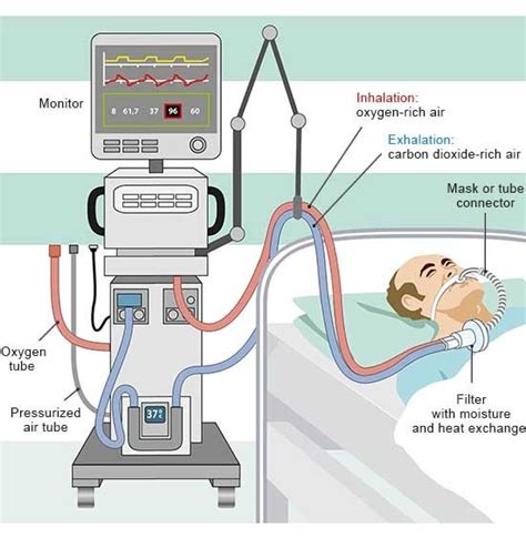 Image result for How Does Ventilator Work