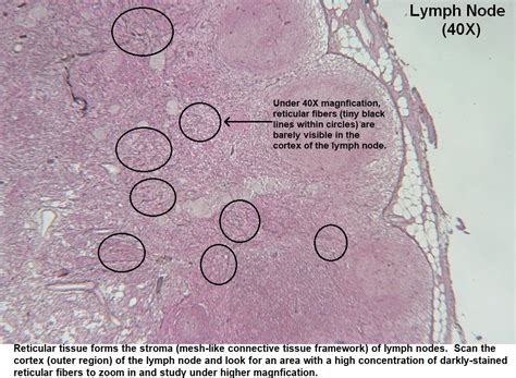 Afbeeldingsresultaten voor Reticular Connective Tissue