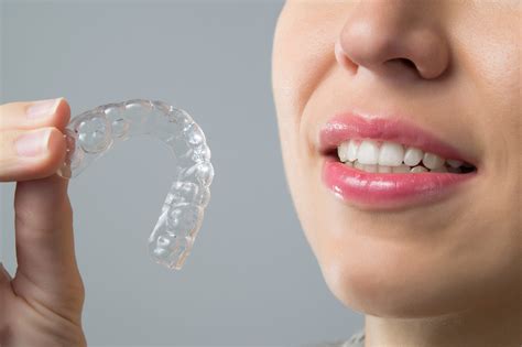 Image result for Retainer Close Up