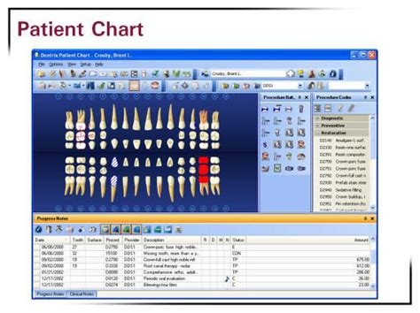 Afbeeldingsresultaten voor Dentrix DXONE