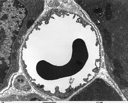 Image result for Capillary in Tissue