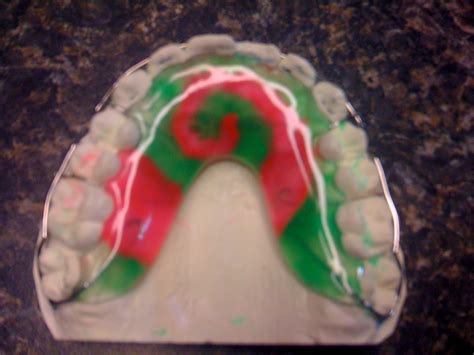 Afbeeldingsresultaten voor Retainer Designer