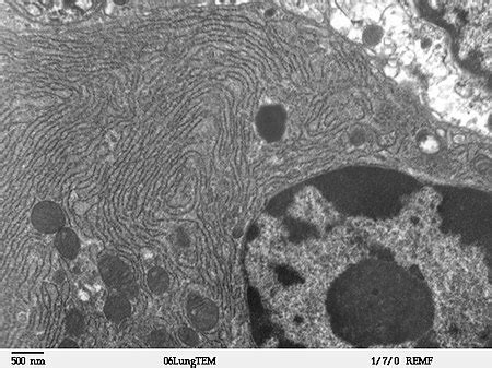 Image result for Endoplasmic Reticulum Under Microscope