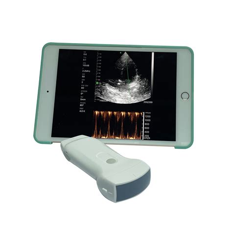 Image result for iPhone Ultrasound Probe