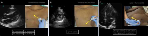 Image result for Ultrasound Probe Heart