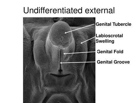 Genital Tubercle に対する画像結果
