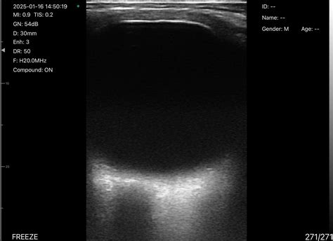 Image result for iPhone Ultrasound Probe