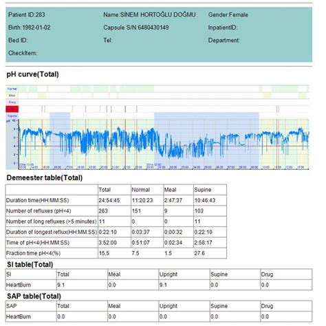 Image result for Ph Chart Recorder