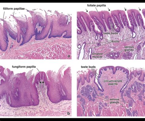 Toradh íomhá ar Filiform Papillae