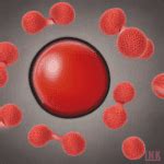 Image result for Multiple Myeloma Brain