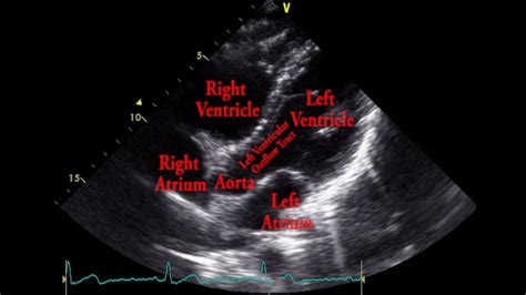 Image result for Ultrasound Probe Heart