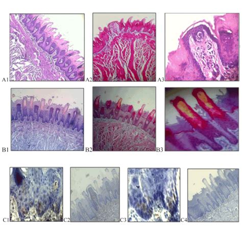 Toradh íomhá ar Filiform Papillae