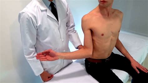 Afbeeldingsresultaten voor Lag Test Shoulder Pain