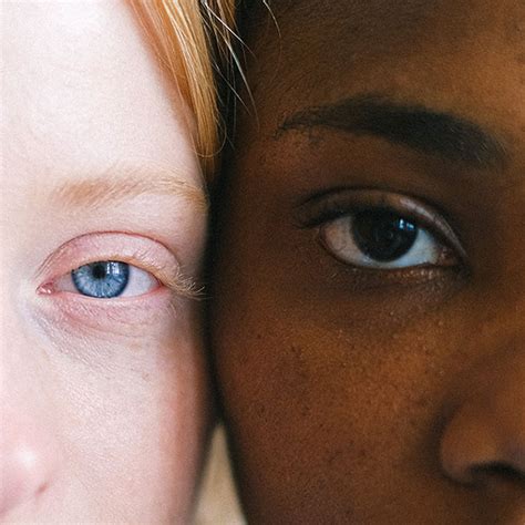 Eye Color Different に対する画像結果