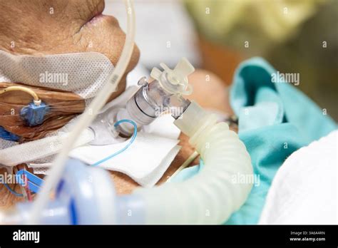 Afbeeldingsresultaten voor How to Use Ventilator