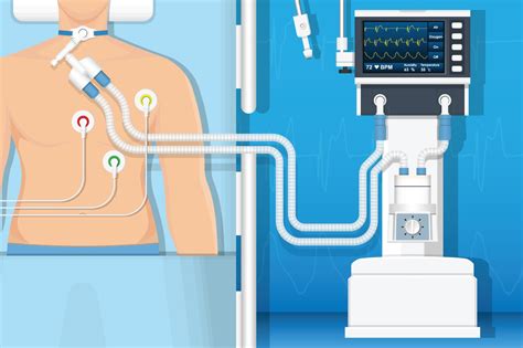 Image result for How Does Ventilator Work