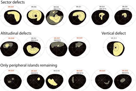 Image result for Aion Visual Field