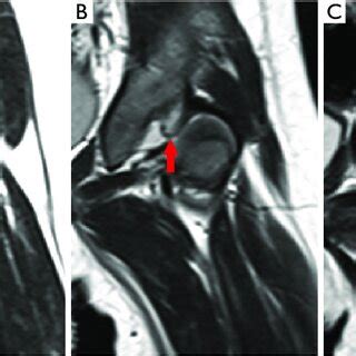 Image result for Over Clock Limbus