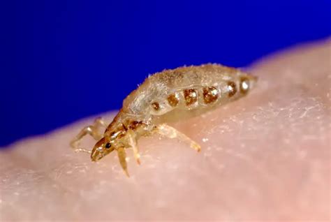 What Do Body Lice Look Like के लिए छवि परिणाम