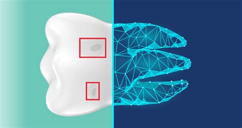 Afbeeldingsresultaten voor Dentrix DXONE