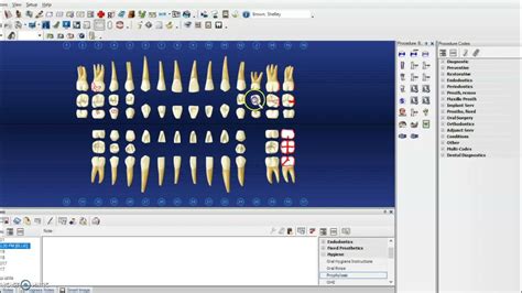 Image result for Dentrix Charting Tutorial