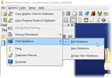 Image result for Dentrix Charting Tutorial