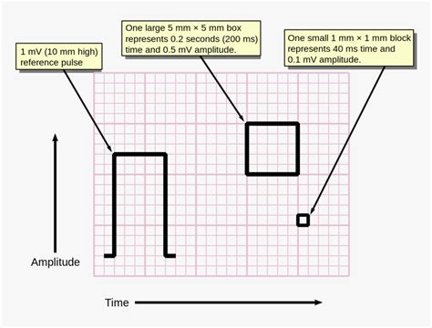 Image result for ECG Graph Paper
