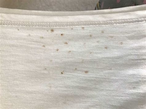 Rust Spots On Clothes に対する画像結果