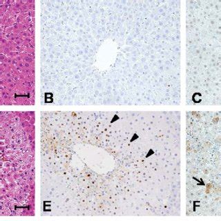 Tunel Assay に対する画像結果