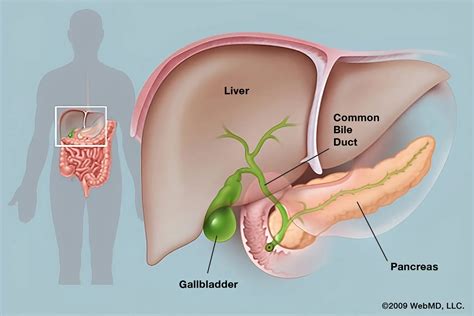 Image result for Sore Gallbladder