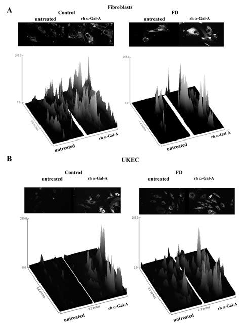 Afbeeldingsresultaten voor ImageJ 3D Surface