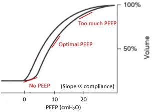 Image result for Intubation Position