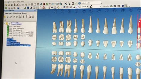 Image result for Dentrix Charting Tutorial