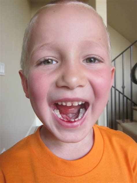 First Tooth Taken Out に対する画像結果