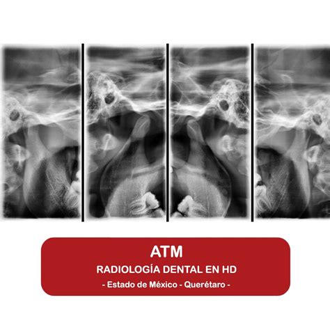 ATM Con Arduino에 대한 이미지 결과