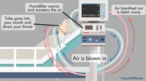 Image result for How Does Ventilator Work