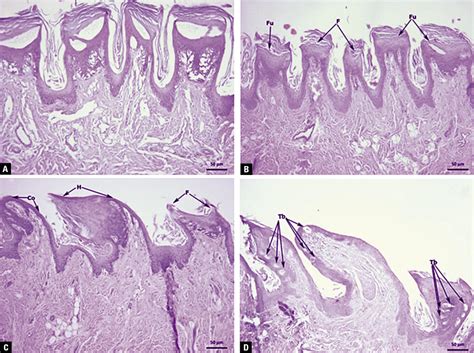 Toradh íomhá ar Filiform Papillae