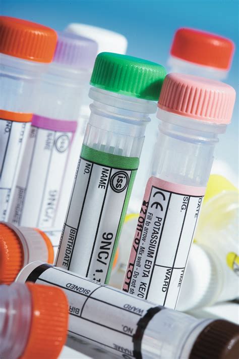 Lab Blood Tubes に対する画像結果