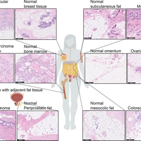Afbeeldingsresultaten voor Wat Adipose Tissue