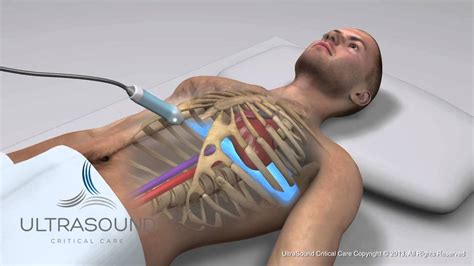 Image result for Ultrasound Probe Heart