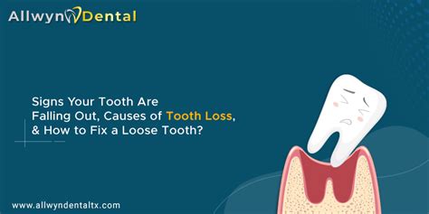 Image result for Loose Tooth Out
