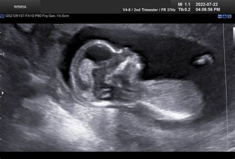 Afbeeldingsresultaten voor Ultrasound ID Code Roblox