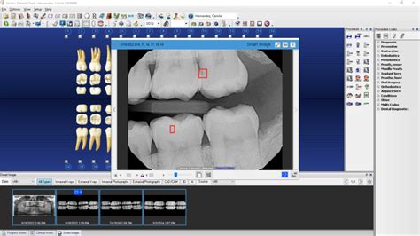 Image result for Dentrix Charting Tutorial