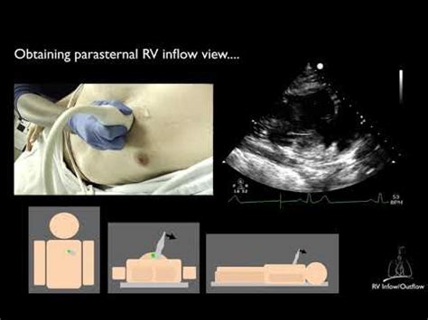 Image result for Heart Dissection Inflow Outflow Method