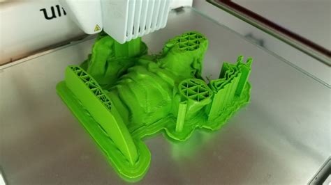 Image result for 3D Anomaly Detection Obstetrics