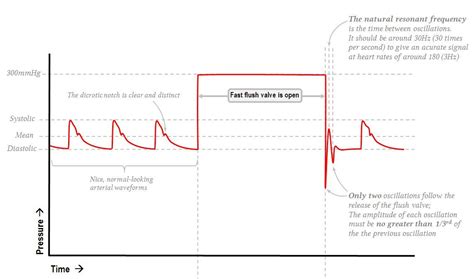 Toradh íomhá ar Normal Arterial Waveform