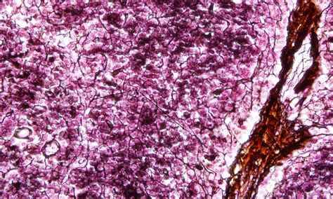 Afbeeldingsresultaten voor Reticular Connective Tissue