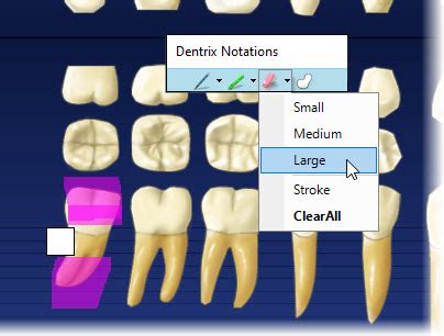 Image result for Dentrix Charting Tutorial