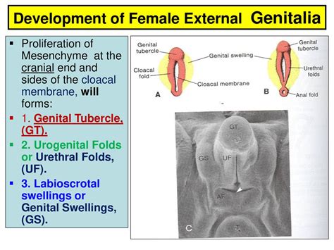 Genital Tubercle に対する画像結果