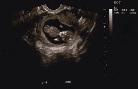 Afbeeldingsresultaten voor Ultrasound ID Code Roblox